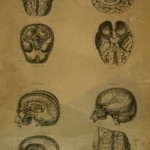 Piedra Litográfica para el Atlas de Anatomía de 1890- Barcelona